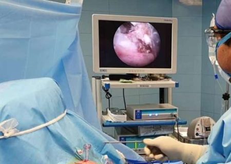 عمل مینیسک زانو به روش آرتروسکوپی