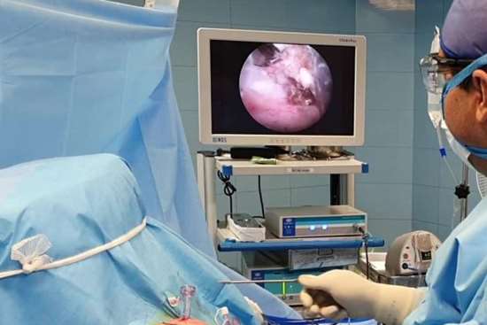 عمل مینیسک زانو به روش آرتروسکوپی