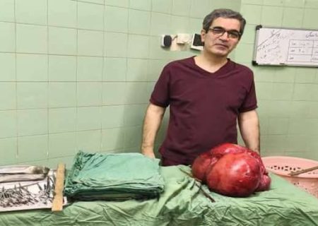 خارج کردن توده سنگین از شکم بیمار پس از سال‌ها درد
