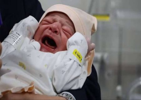 جگرگوشه پیوند کبد گیلان متولد شد