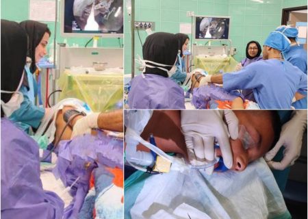 خروج موفقیت‌آمیز سوزن از روده کودک ۱۰ ساله در مرکز آموزشی و درمانی ۱۷ شهریور
